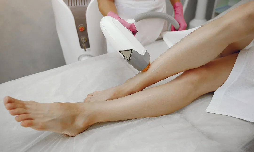 Consultație pentru epilare cu laser diodă Craiova înaintea începerii tratamentului