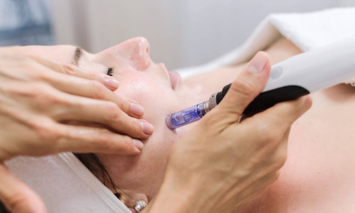 tratament-dermapen-pentru-ten Tratament Dermapen pentru îmbunătățirea texturii și luminozității tenului