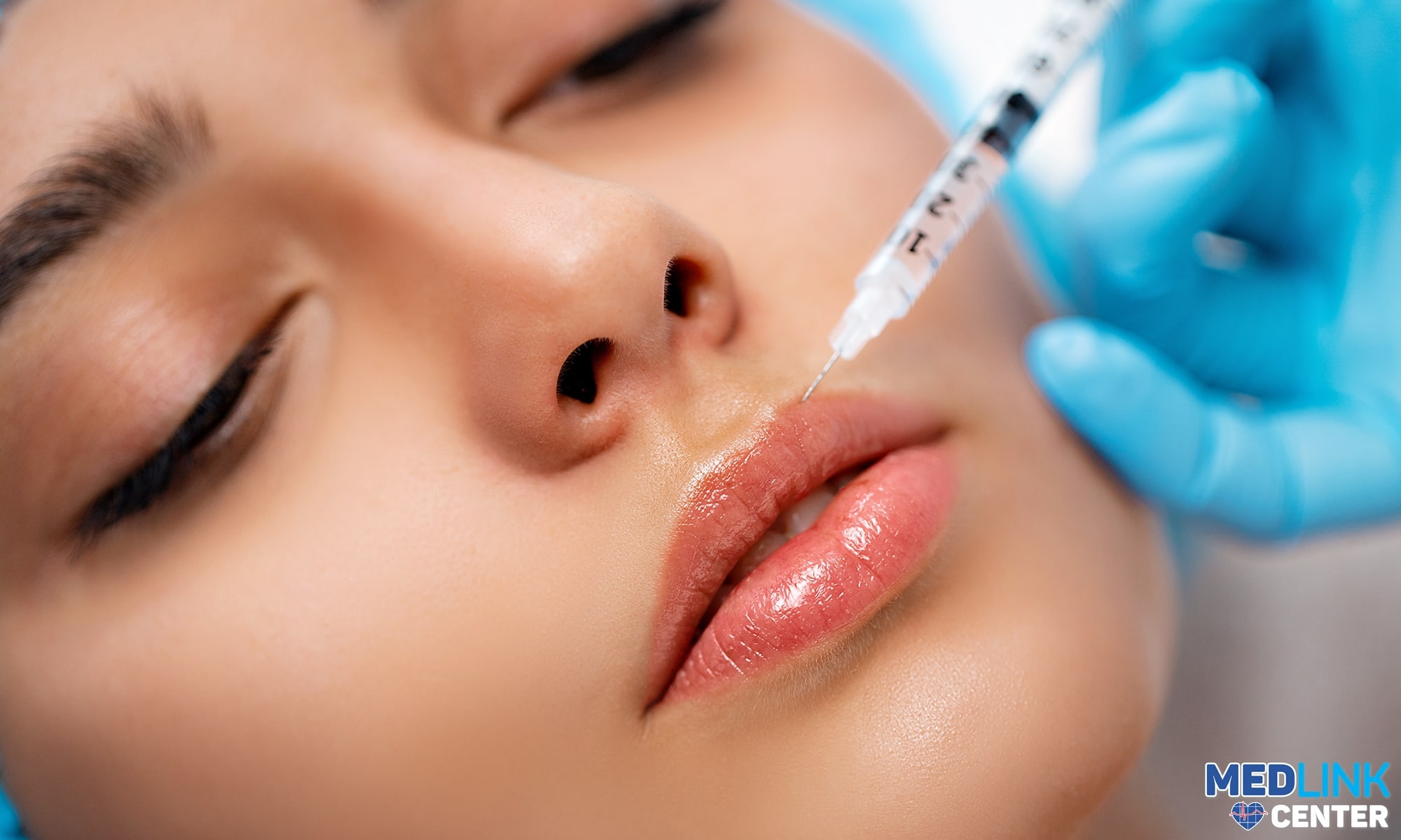 juvederm acid hialuronic filler riduri clinica medlink juvederm acid hialuronic filler riduri clinica medlink