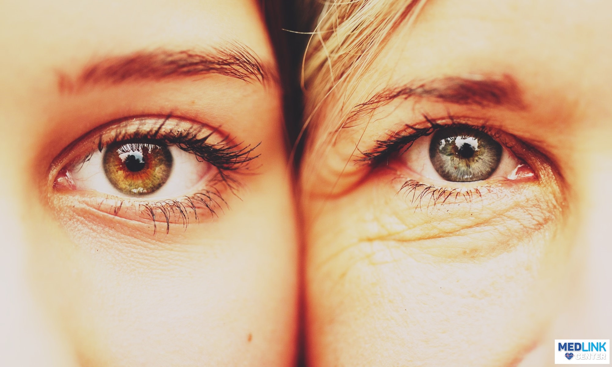 botox riduri ochi blefaroplastie clinica medlink craiova botox riduri ochi blefaroplastie clinica medlink craiova