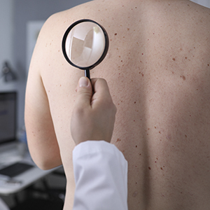 departament medical clinica medlink dermatologie patologica