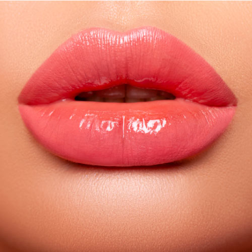 russian lips volumizare buze cu AH