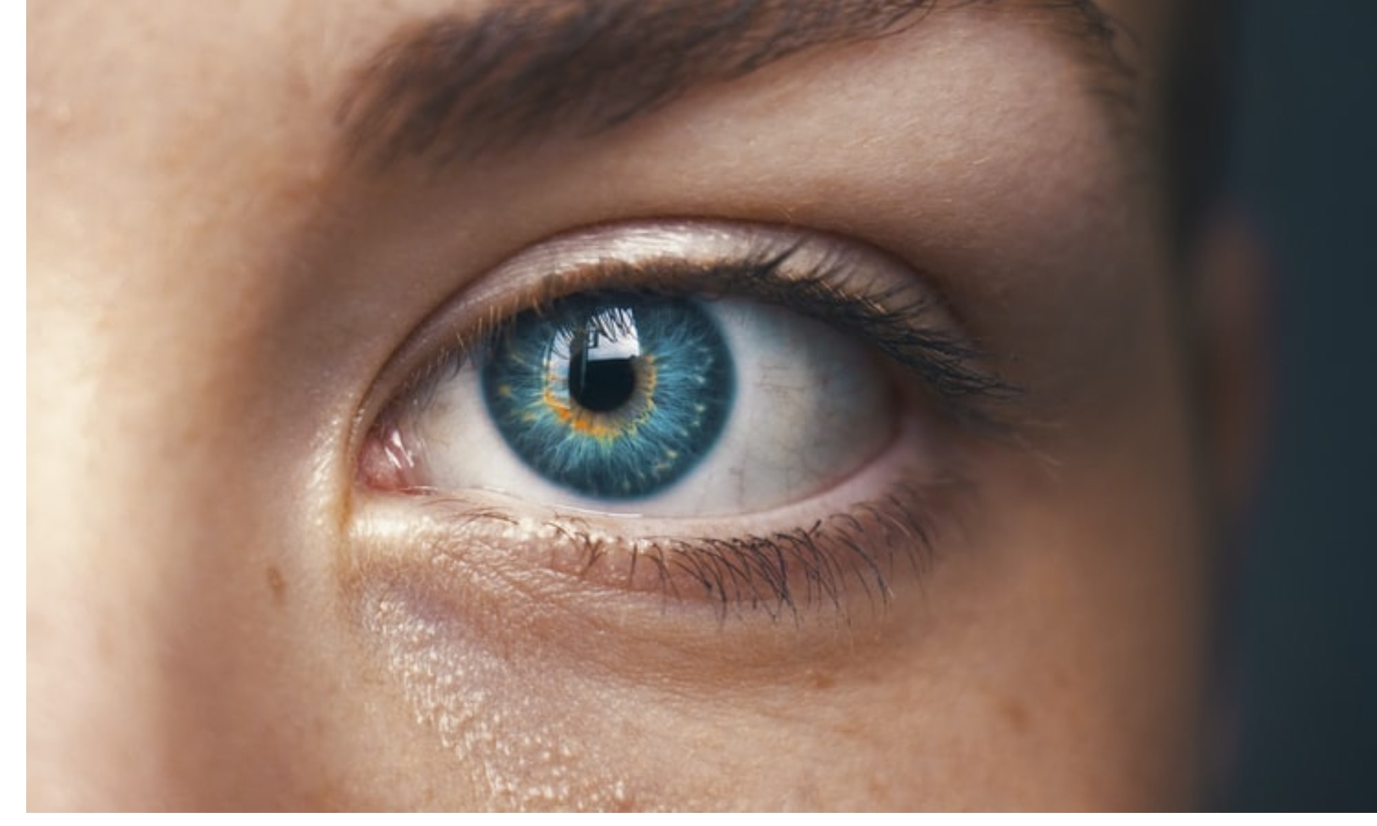 Totul de stiut despre acid hialuronic pentru cearcane 1 min