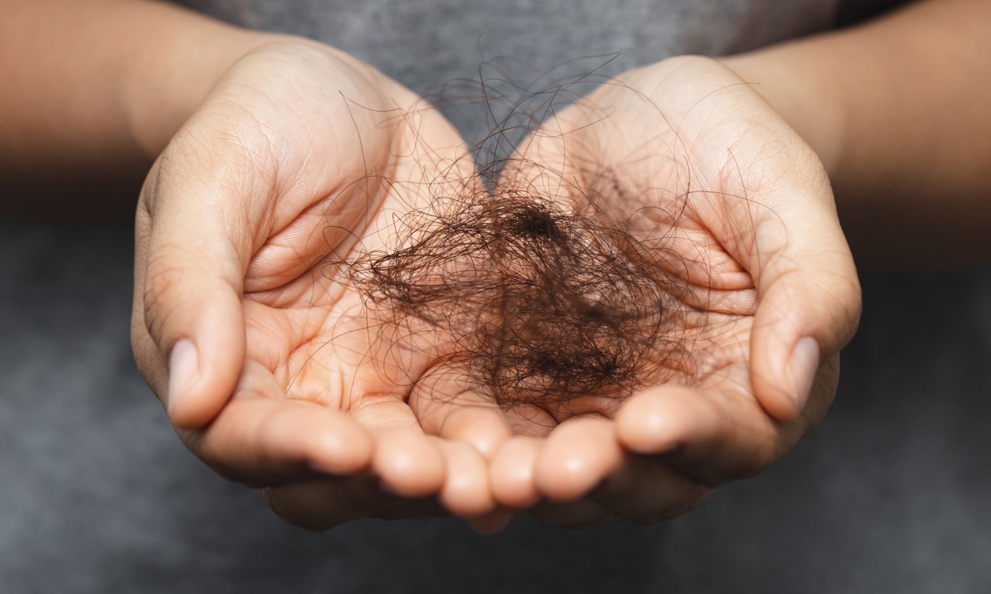 1. Caderea parului 1. Caderea parului