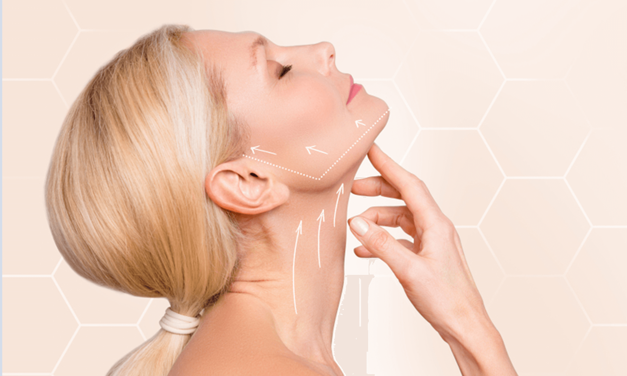 FOTO 1 – tratament jawline conturare linie maxliar dermatologie estetica craiova medlink center