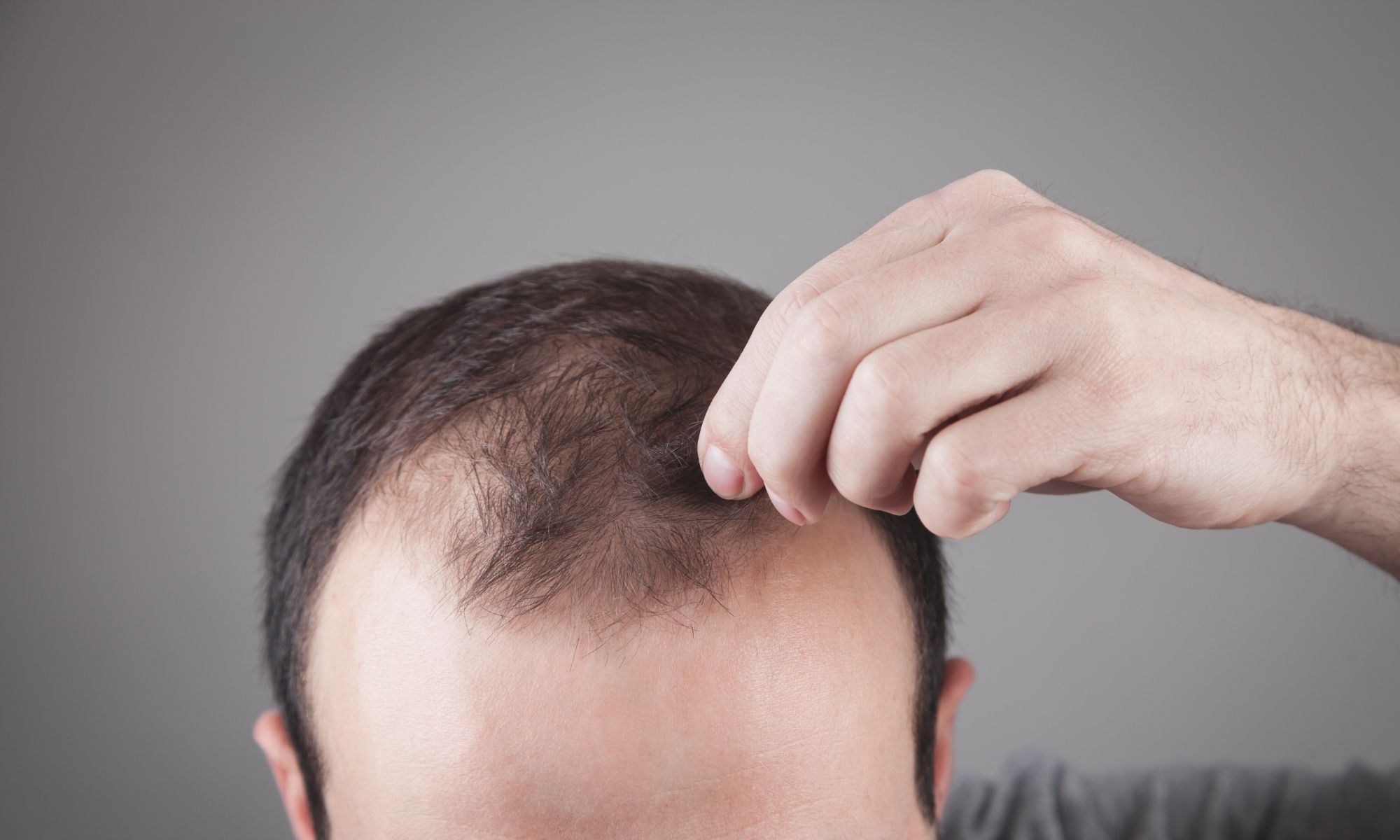 Tratament chelie clinica MEdlink Craiova cover