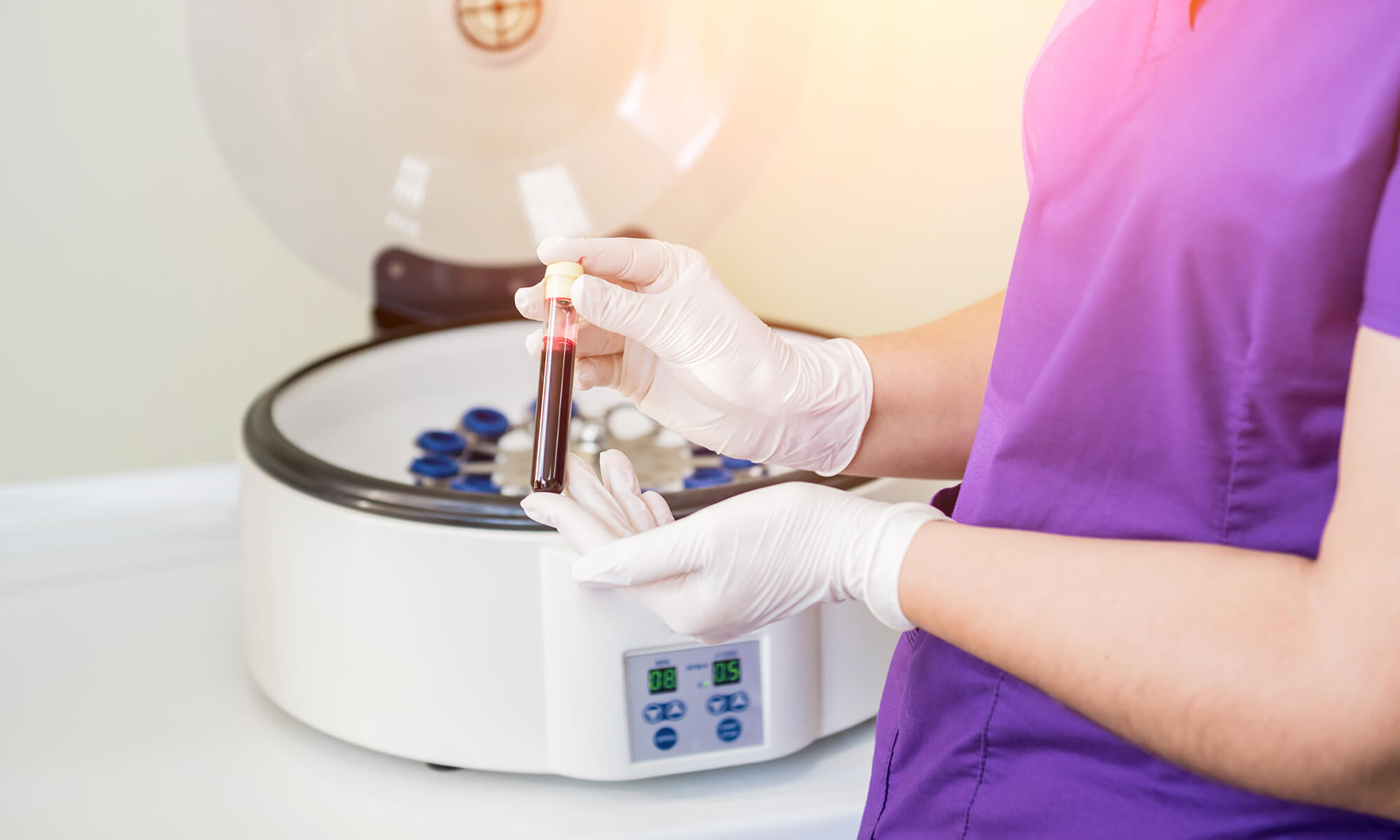 Ce rezultate are renumita terapie vampir in estetica