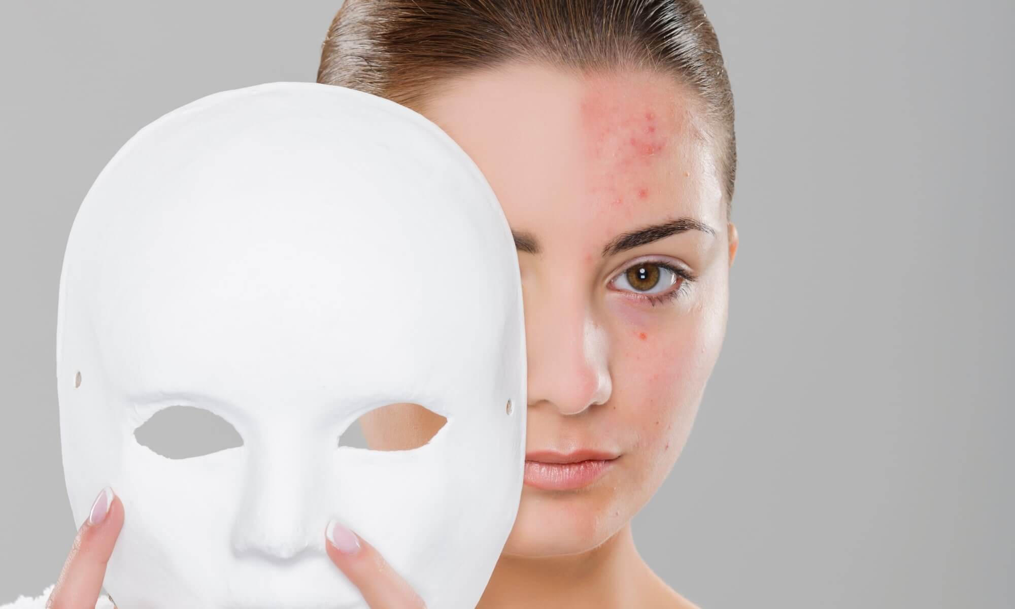 Uita de cicatricile inestetice cu un tratament cu plasma Uita de cicatricile inestetice cu un tratament cu plasma