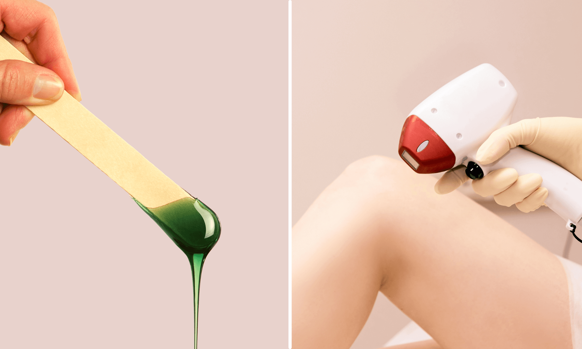 Epilarea cu ceară sau cu laser