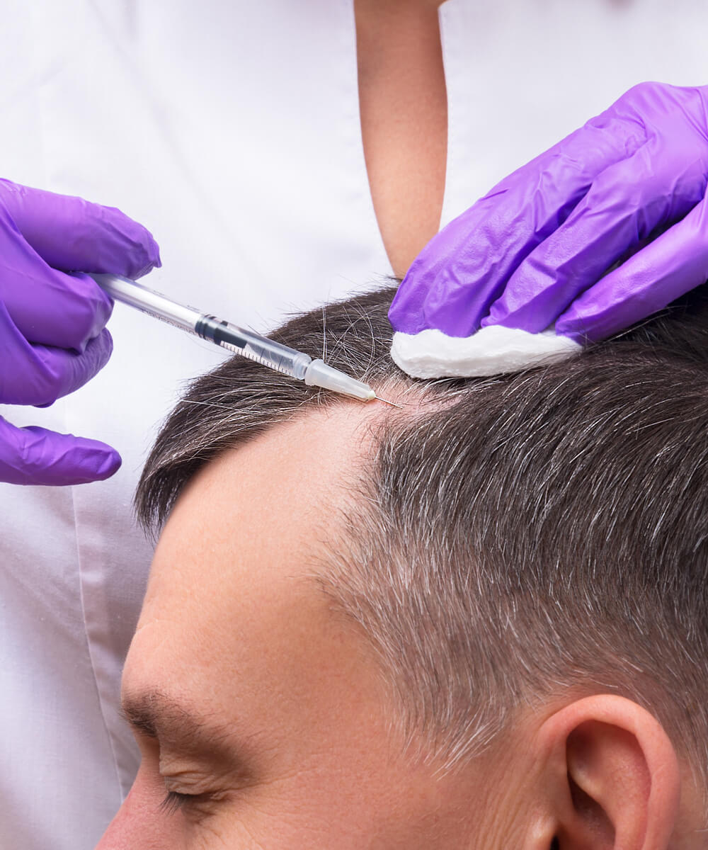 caderea parului caracteristici