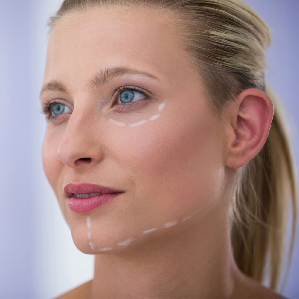 facelift nechirurgical estetixlift main page medlink