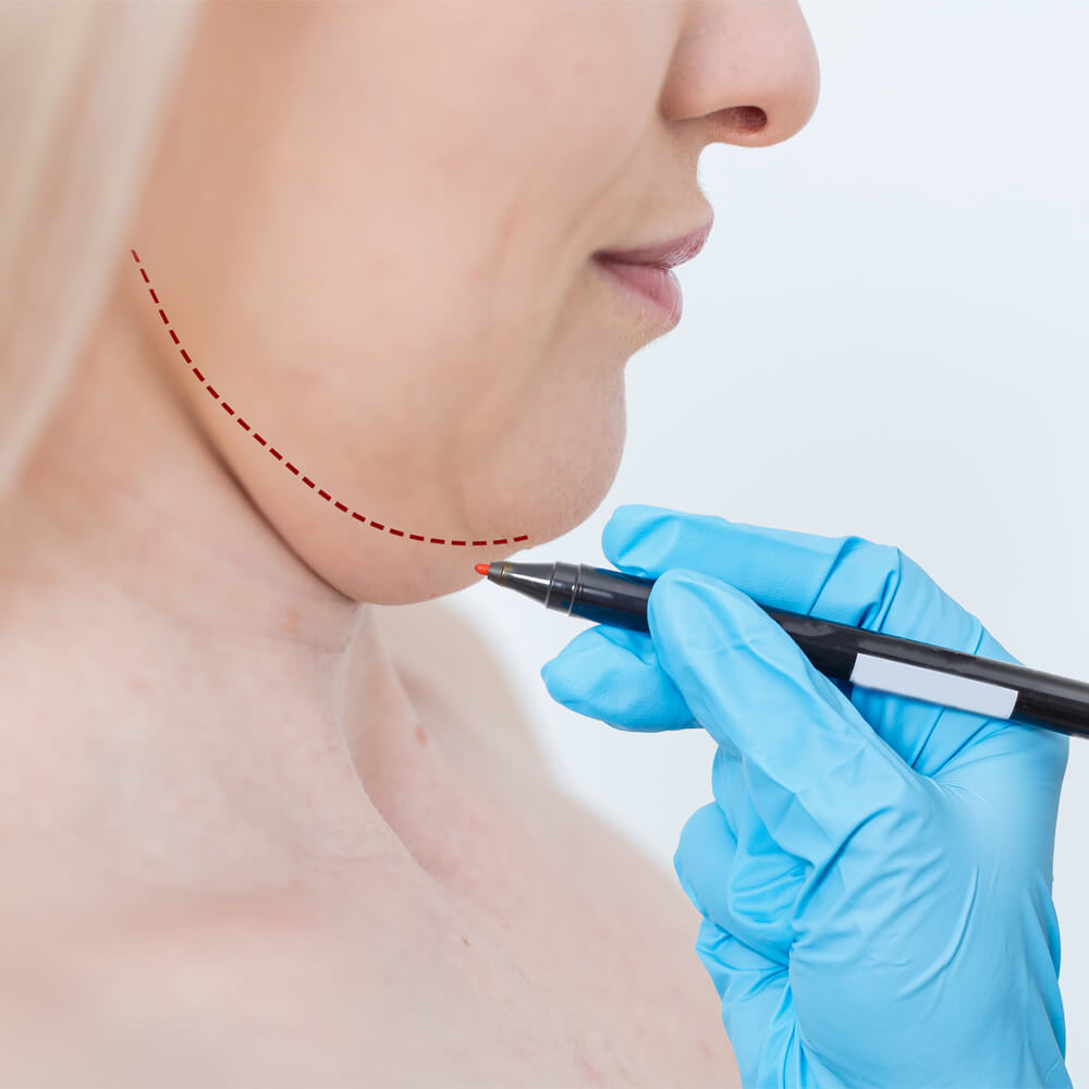 injectii aqualyx arderea grasimilor main page medlink