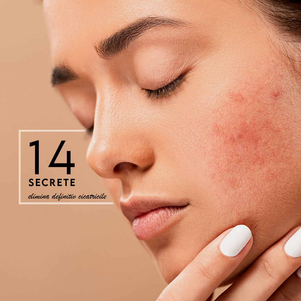 tratamente cicatrici main page medlink