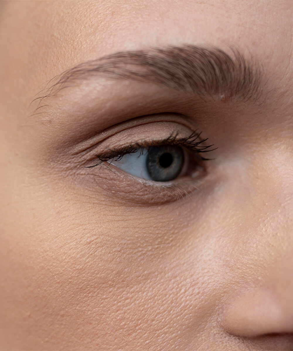 caracteristici PRF cearcane