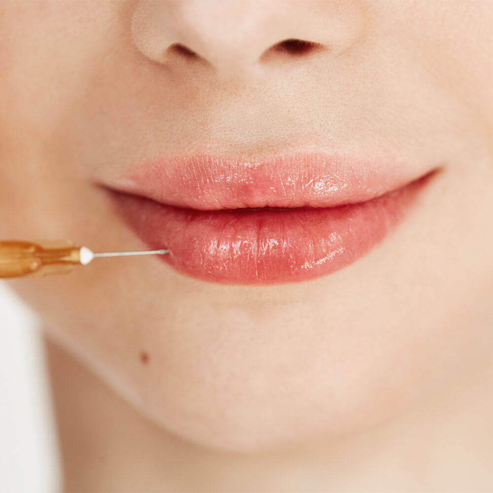 hialuronidaza main page