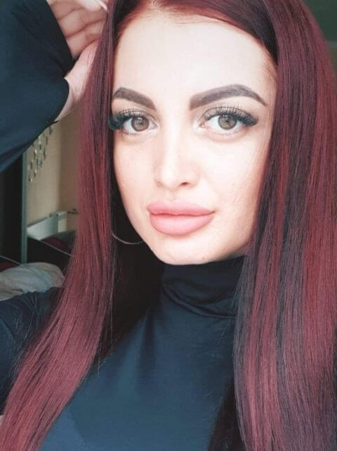 testimonial hialuronidaza