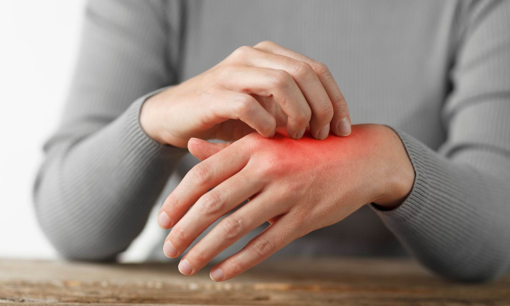 7 boli de piele transmisibile si cum eviti infectarea cu acestea