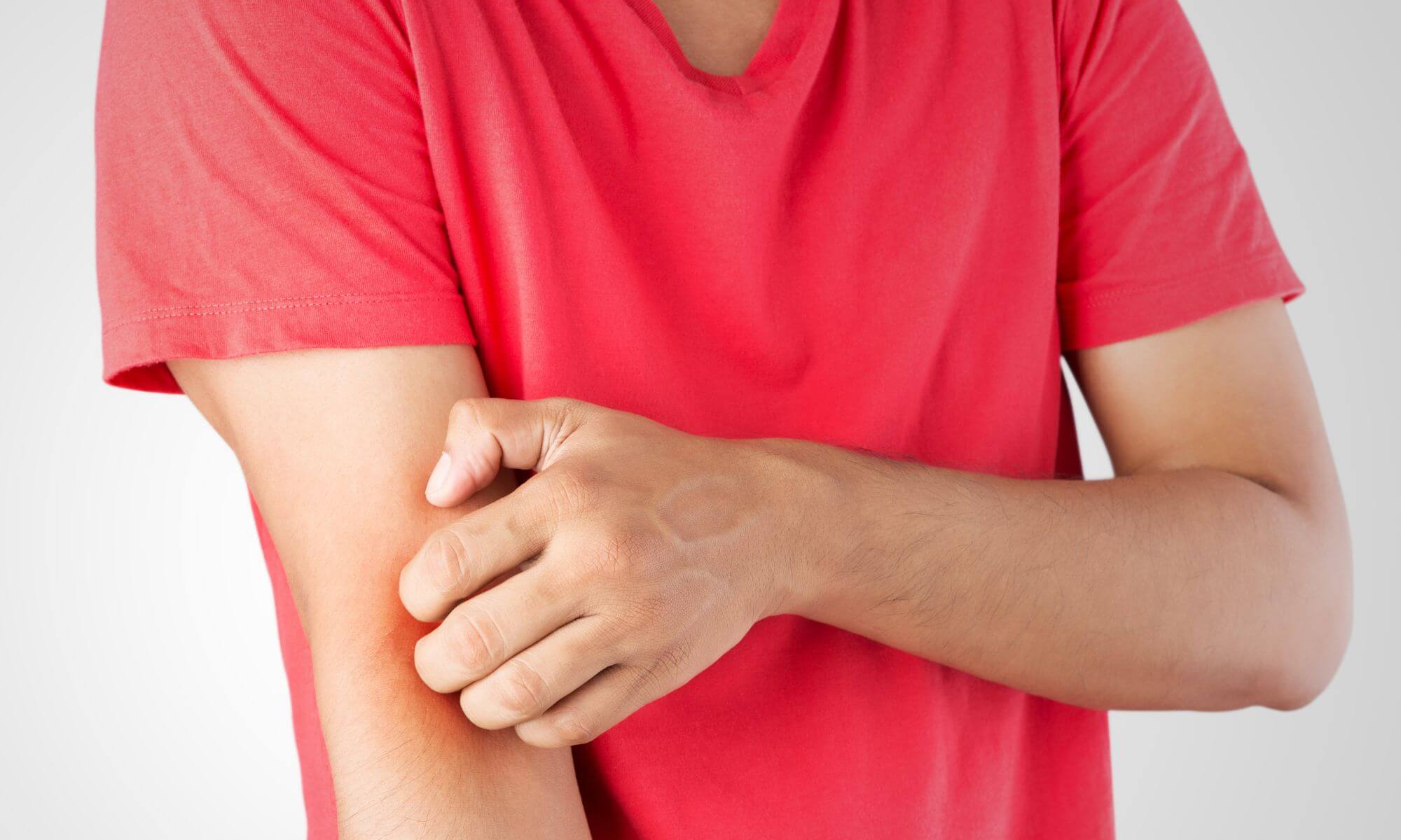 Bolile de care poti suferi cand ai mancarimi de piele