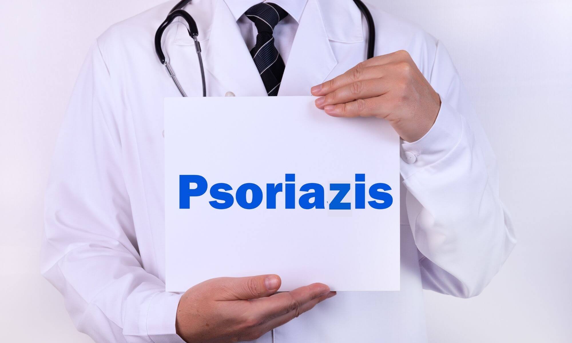 Cele mai critice sfaturi medicale cand suferi de psoriazis