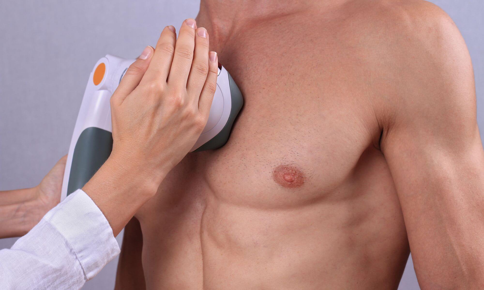 Epilare definitiva barbati te epilezi cum si unde trebuie