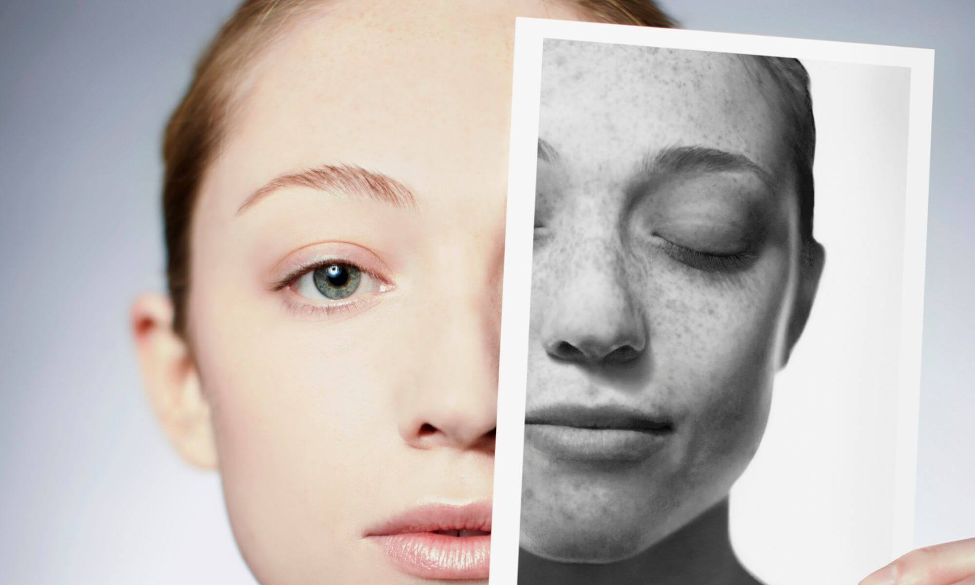 15 afectiuni dermatologice care tin cabinetele medicale pline