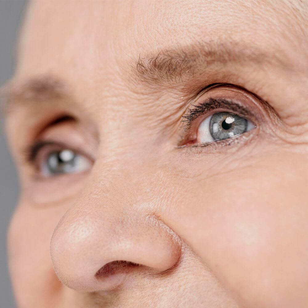 excizie xantelasme main page