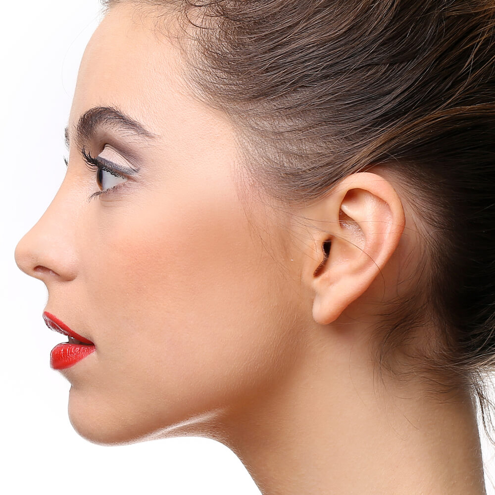 otoplastie main page