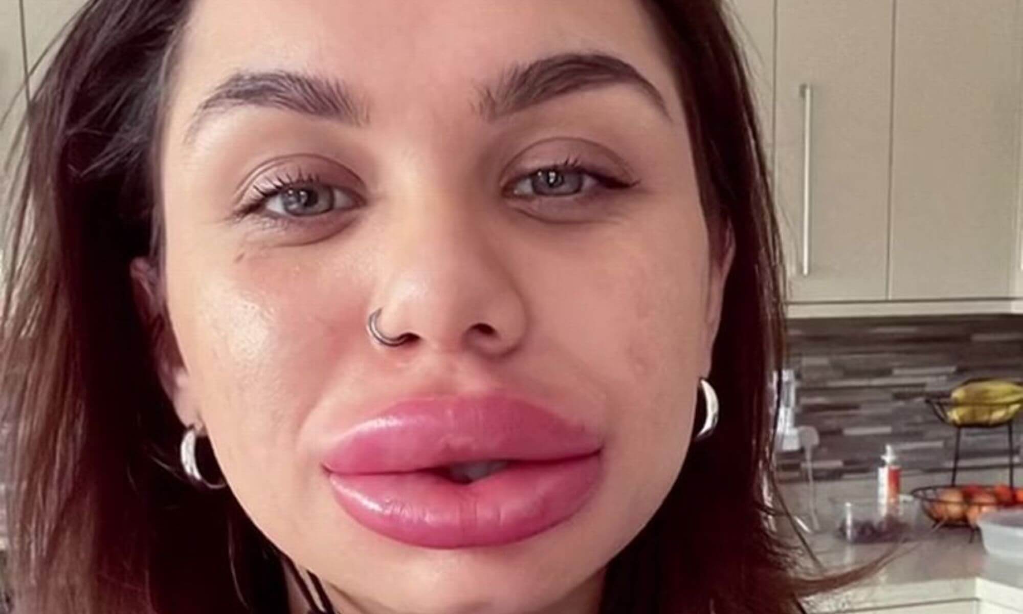 Cat de natural pot arata unele „botoxate