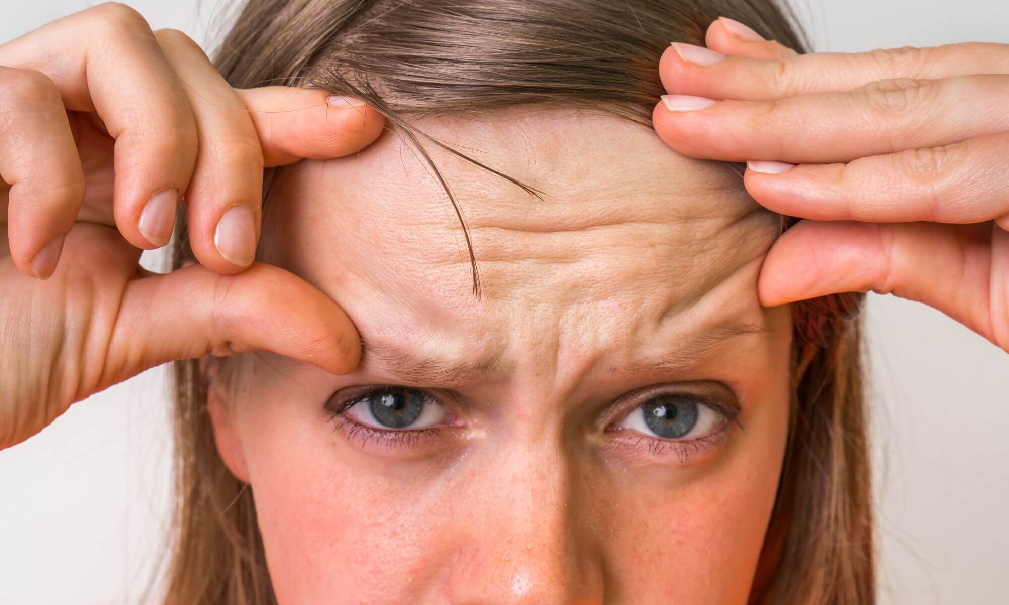 Ce tratament pentru riduri pe frunte recomanda dermatologii in prezent