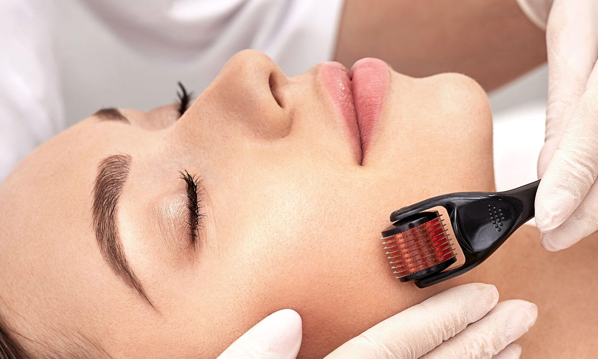 Dermaroller pentru fata de ce ar trebui sa fii precauta