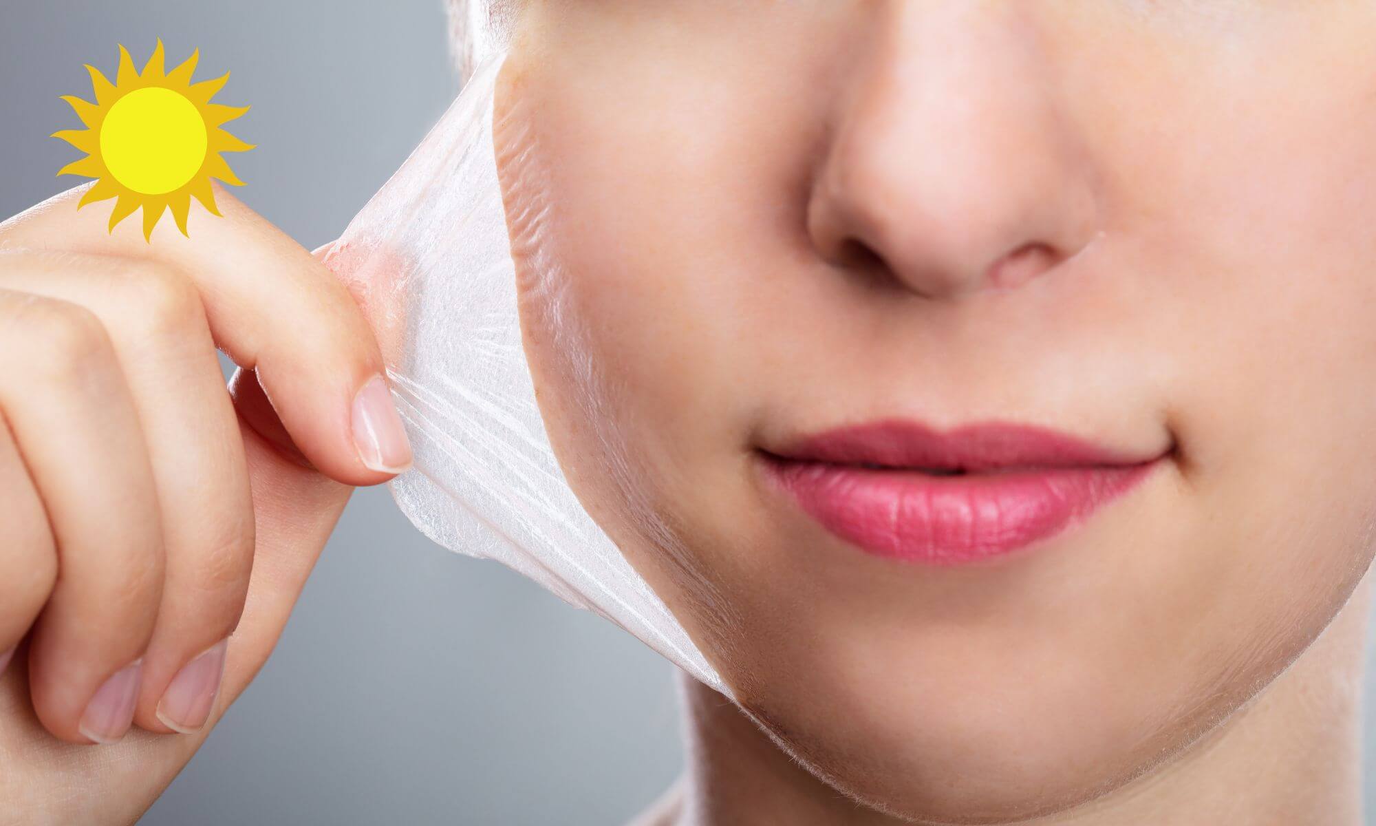 Poti face un peeling chimic vara Raspunsul te ar putea surprinde