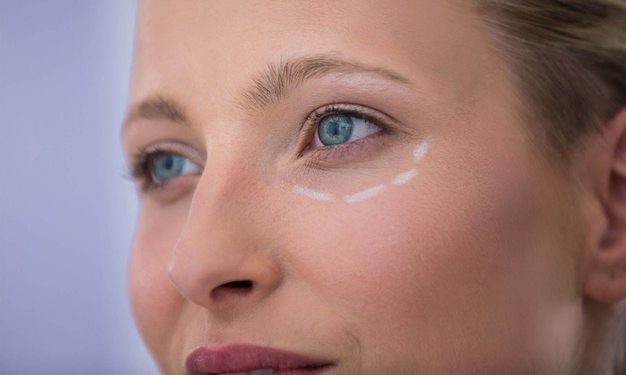 Nevoia de ridicare pleoape cand apare si ce putem face