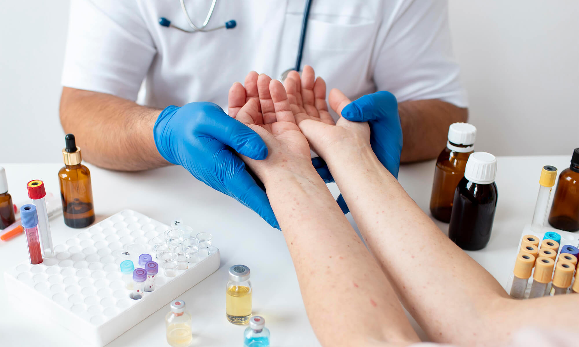 Uite ce leacuri te ajuta sa eviti boala Dupuytren