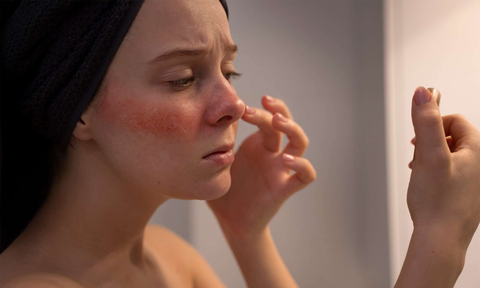 Tratament rozaceea cum tratam o afectiune comuna a pielii