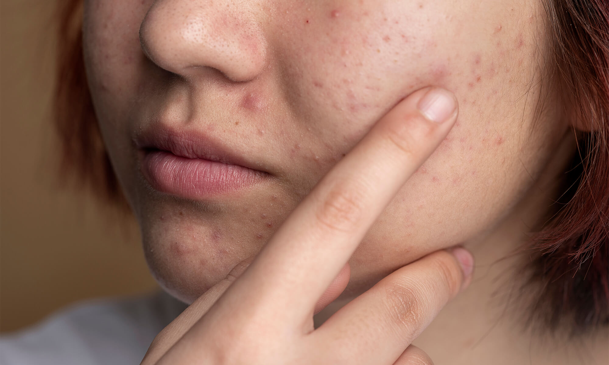 Ce sa faci cand ai o eruptie cutanata si cum o tratezi