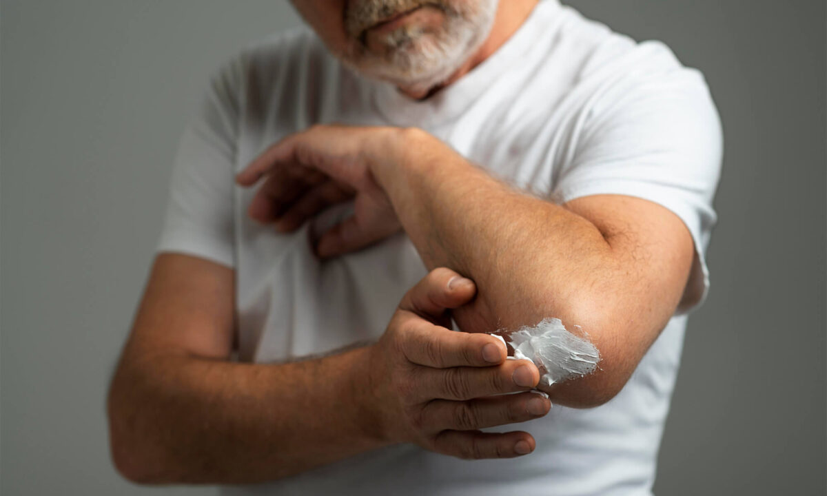 Dermatita atopică evaluată și monitorizată de medic dermatolog la Clinica Medlink Craiova