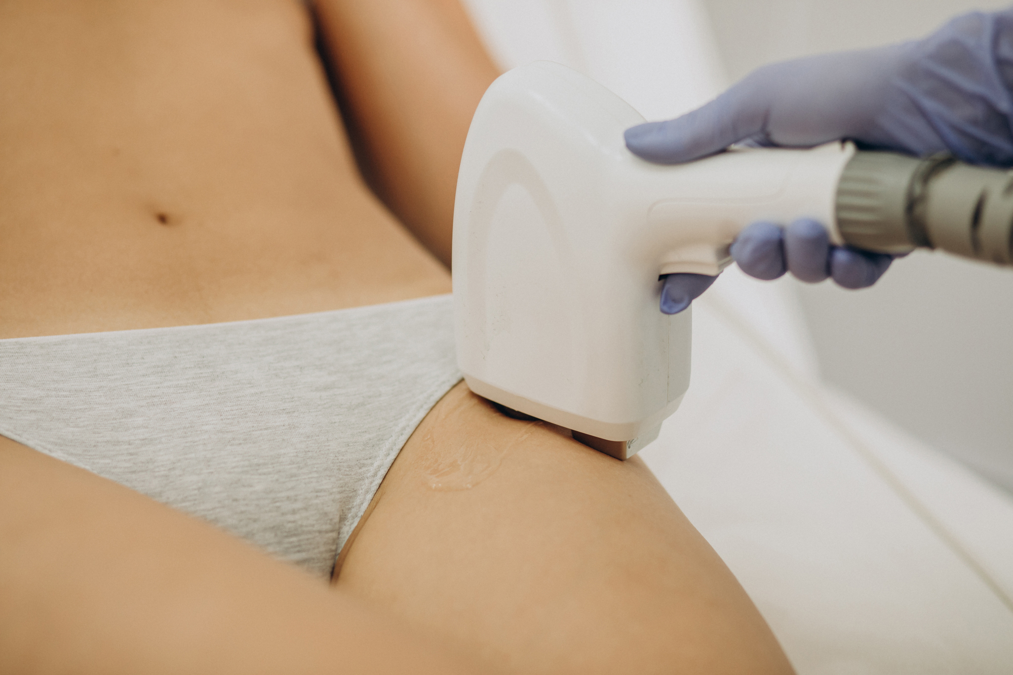 Epilare inghinală femei la Clinica Medlink Craiova