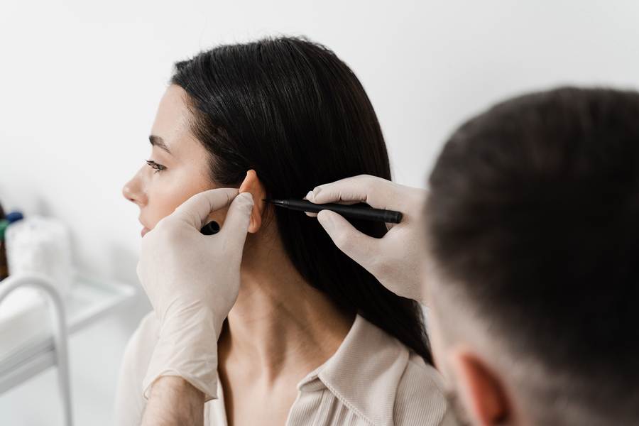 incizie-in-spatele-urechii-otoplastie Poziția inciziei în spatele urechii după otoplastie
